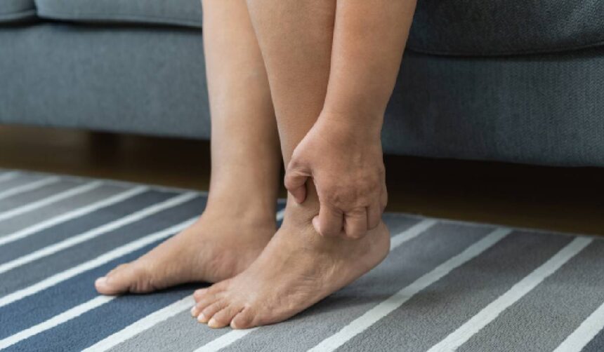 Mâncărimea pielii fără erupții: schimbările care apar odată cu venirea căldurii 51 mancarimea pielii fara eruptii ce se schimba odata cu sezonul cald 6a0187f2113a2