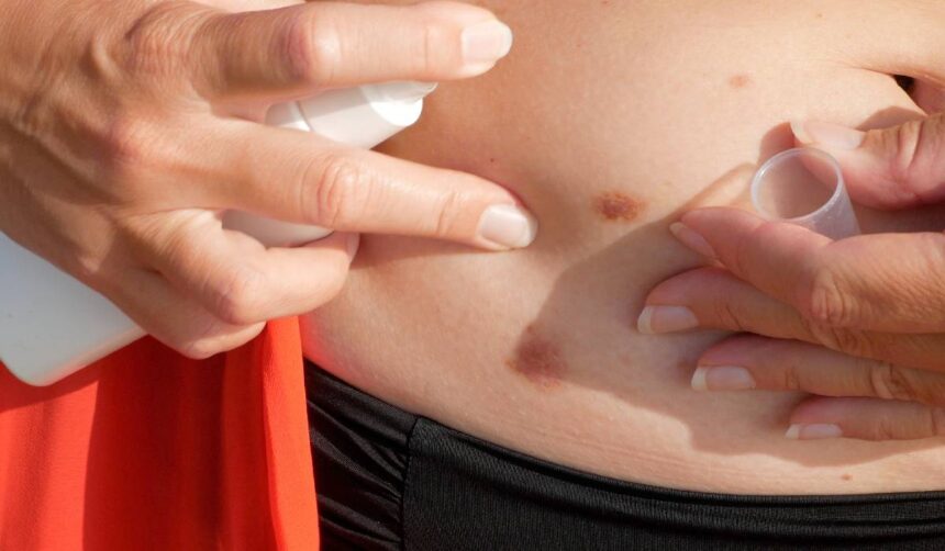 mituri despre cancerul de piele dr ioana badircea pacientii au tendinta sa asocieze termenul de cancer fie cu eruptiile extinse la nivelul pielii 6a16a5e88a658