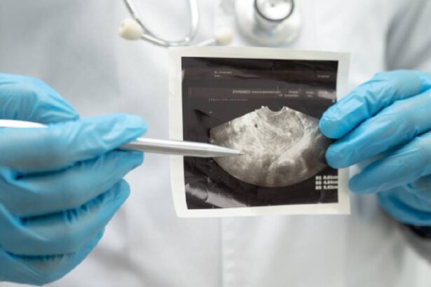 tulburarile psihice la pacientii oncologici dr romina catuti diagnosticul de cancer este un soc existential 6a1579b92e555
