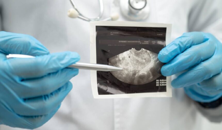 Tulburările psihice la pacienții cu cancer: Dr. Romina Cătuți explică impactul diagnosticului 51 tulburarile psihice la pacientii oncologici dr romina catuti diagnosticul de cancer este un soc existential 6a1579b92e555
