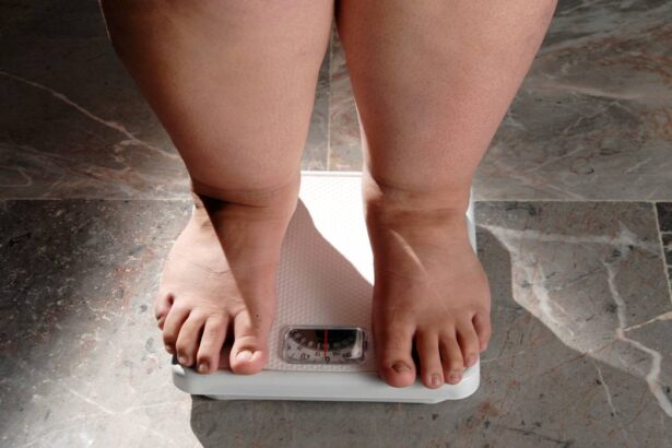 cand dietele nu mai functioneaza cum iti dai seama ca ai nevoie de o solutie medicala pentru obezitate 6a33df2ab34bf