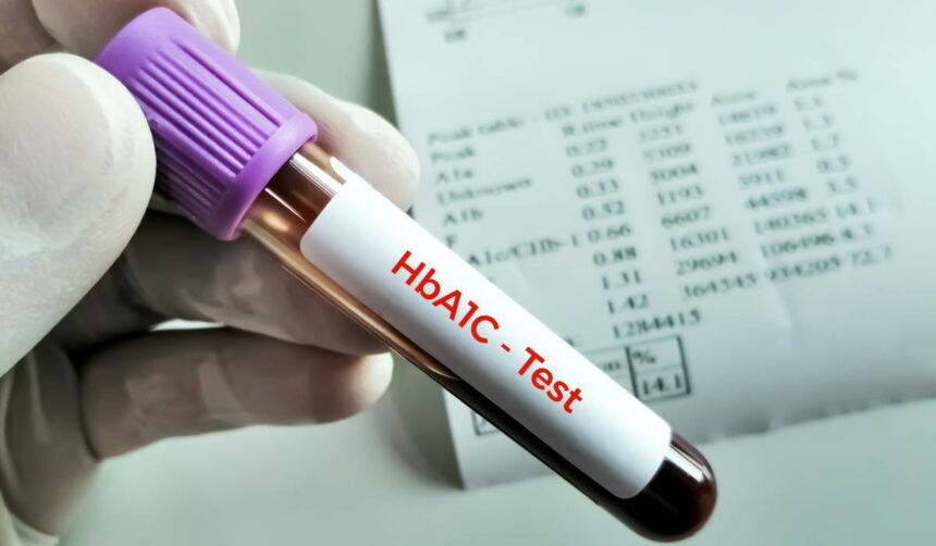 de ce poate creste hemoglobina glicata hba1c glicemia ridicata nu este singura explicatie 6a5ccbd07ac35